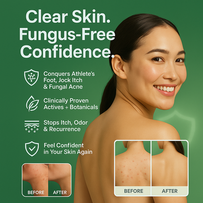 Antifunga Relief Bar — High-Strength Antifungal Soap