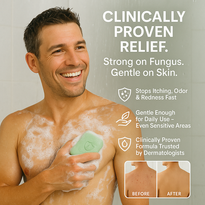 Antifunga Relief Bar — High-Strength Antifungal Soap